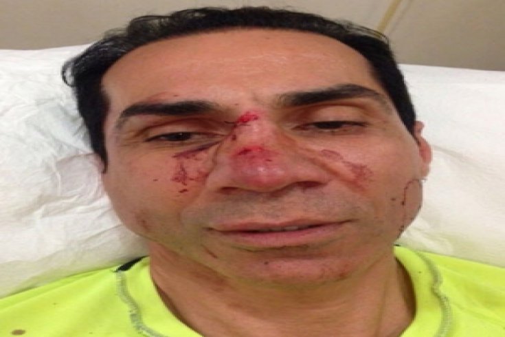 CHP'li Hüseyin Sağ'a yapıla çirkin saldırının görüntüleri ortaya çıktı