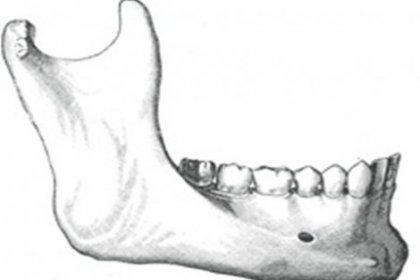 6 bin yıllık diş dolgusu bulundu