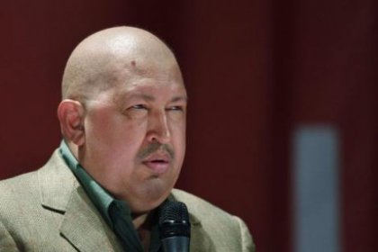 Chavez: Dikişlerim Alındı
