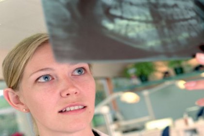 Diş röntgenindeki tehlike