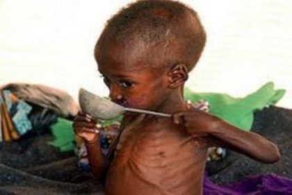 Somali'de 5 gündür hiç bebek ölmedi