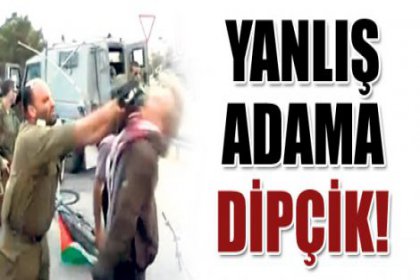 Yanlış adama dipçik