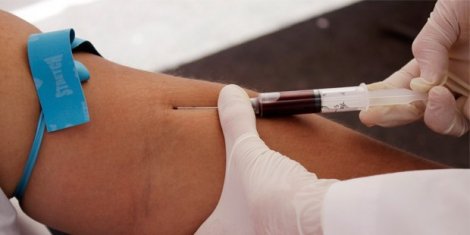 İtalyan doktorlar, çaresi bulunmayan genetik hastalığı HIV'le tedavi etti