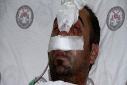 Bir polis vahşeti daha!