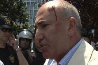Ergenekon'da, CHP'li Mahmut Tanal yaralandı