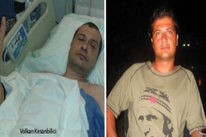 'Gezi'de polisin attığı demir bilye ile gözünü kaybetti, yaşadıklarını anlattı