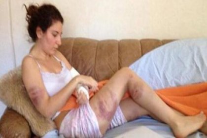 İzmir'de Gezi Parkı eyleminde polisten gördüğü şiddetin fotoğrafını paylaştı