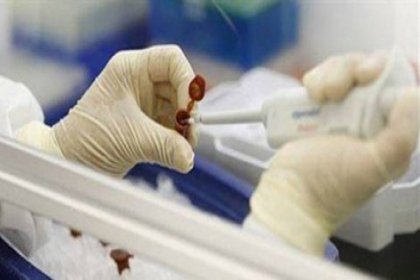 Kök hücreyi beyin hücresine dönüştürmenin yöntemi keşfedildi