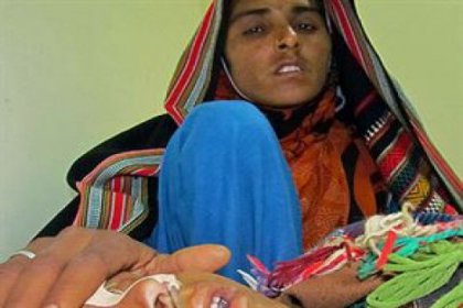 Pakistan'da kızamık 143 can aldı