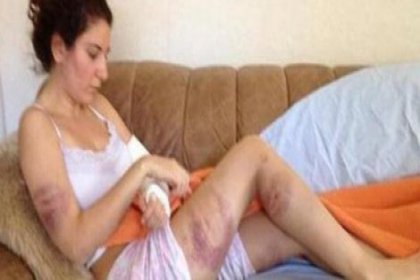 Üniversite öğrencisine işkence yaptılar, 'Tayyip'i seviyorum' dedirtmek istediler