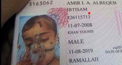 Gazzeli çocuğa, 'yaralı fotoğraf'la pasaport