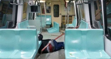 Metroda kalçasına demir saplanan Fatih Çoban o anı anlattı: Oturuyor alsaydım ölmüştüm