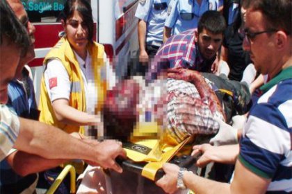 Aksaray'da Kulak vahşeti