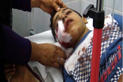 Gaz bombasıyla vurulan 9 yaşındaki çocuk ağır yaralandı