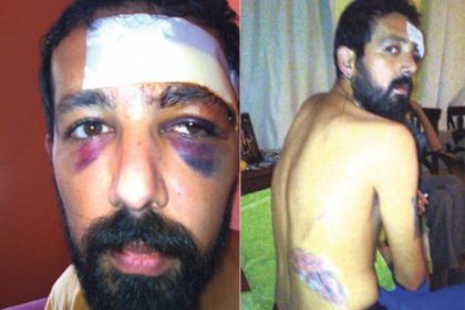 Gezi'deki polise işkenceden 18 yıl hapis istemi