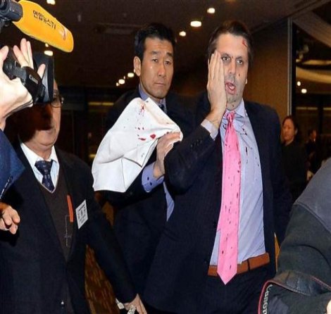 ABD'nin Seul Büyükelçisi Mark Lippert'a usturalı saldırı