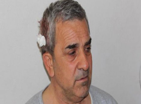 CHP İlçe Başkanı'na sopalı saldırı