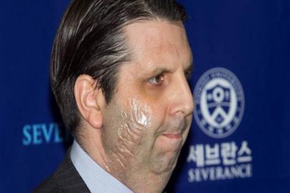 Güney Kore'de saldırıya uğrayan ABD'li büyükelçi taburcu oldu