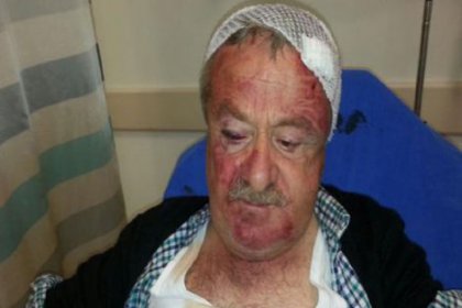 AKP'li Başkanı suçlayan MHP'li meclis üyesine saldırı