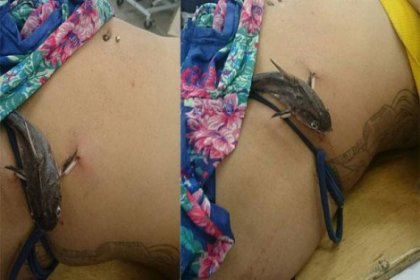 Karnına saplanan kedi balığını ameliyatla çıkardılar