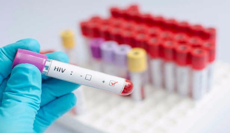 Türkiye’de 15 bin kişi HIV virüsü taşıyor