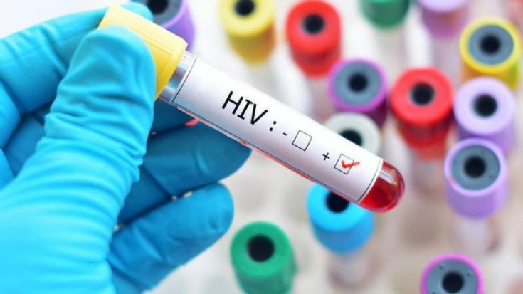 19 yıl sonra yeni HIV türü bulundu