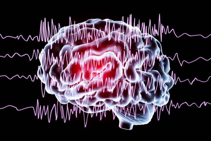Epilepsi hakkında bilinmesi gereken 9 önemli nokta