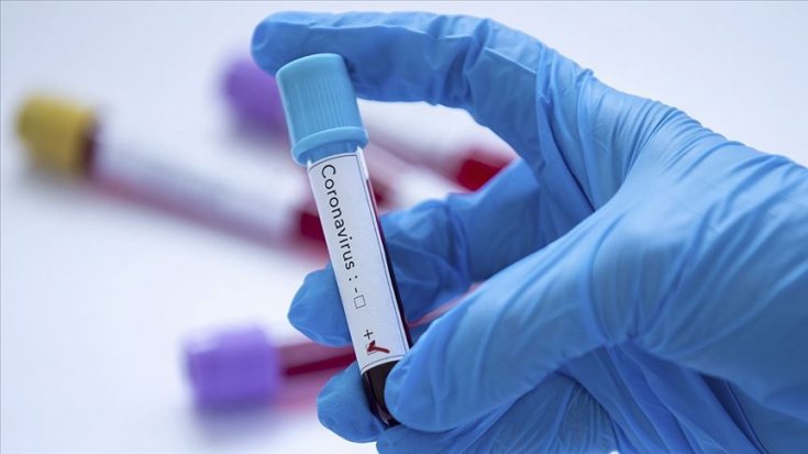 24 aile hekimi ile hemşirenin koronavirüs testi pozitif