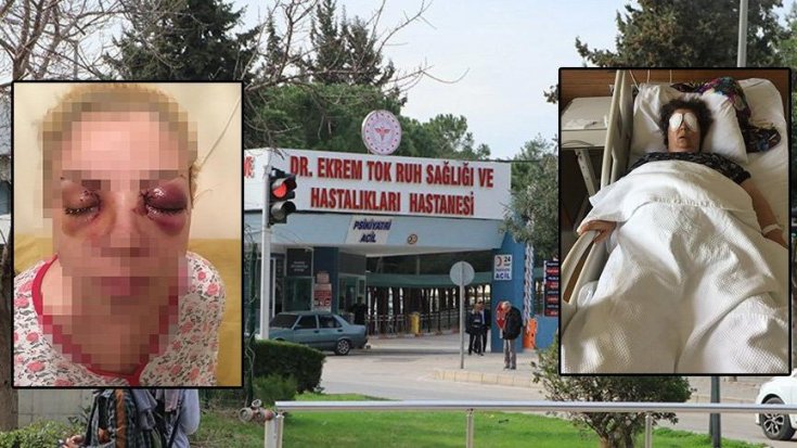 Akıl hastanesinde oda arkadaşının gözlerini oyan şizofreni hastası, 2 yıl önce de aynı şeyi yapmış