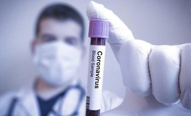 Almanya’da koronavirüs nedeniyle ölenlerin sayısı 2 bin 349’a çıktı
