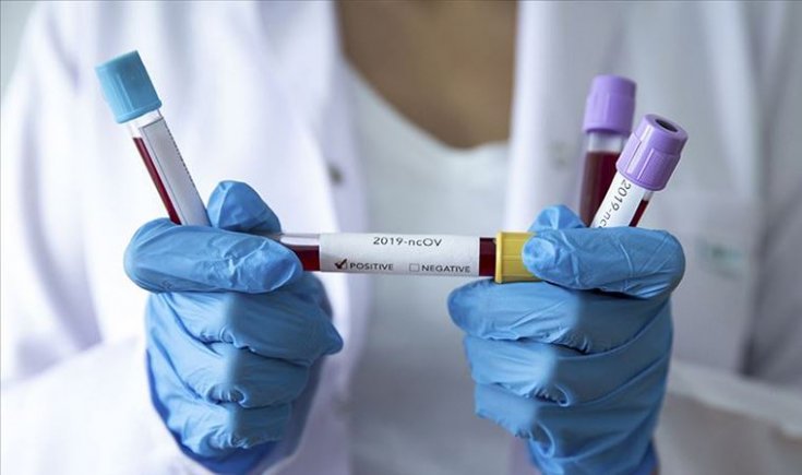 'Antikor testleri pozitif olmuş hasta oranı zannettiğimizden çok düşük, toplumsal bağışıklık için çok gerideyiz'