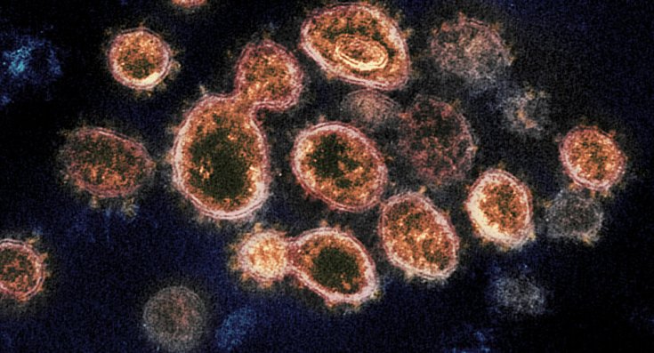 Antikorlara yakalanmayan koronavirüs mutasyonu tespit edildi