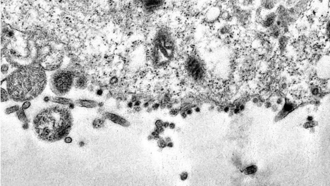 Bilim insanları koronavirüsün hücreye saldırı anını görüntüledi