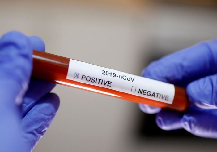 Çin'de koronavirüs salgınında ölenlerin sayısı 2 bin 594'e yükseldi