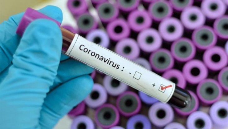 Corona virüs testi nasıl yapılıyor?