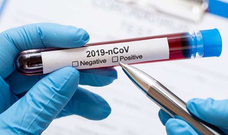 Dünya genelinde koronavirüsten can kaybı 462 bin 691’e yükseldi