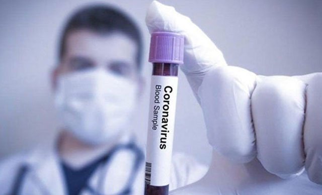 İngiltere’de son 24 saatte koronavirüsten 569 ölüm