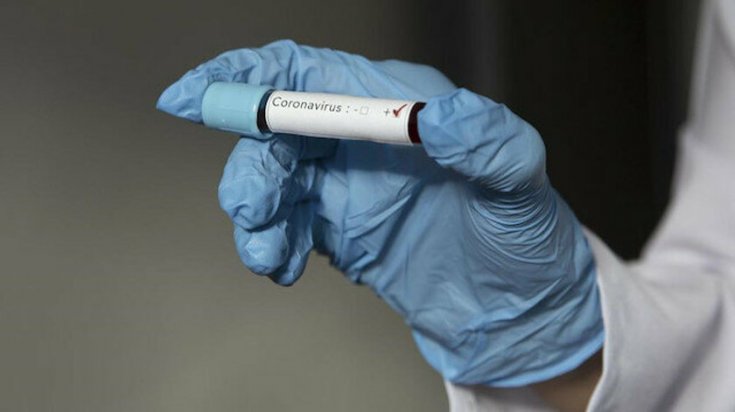 İran’dan korkutan koronavirüs açıklaması: 13 yeni vaka daha tespit edildi