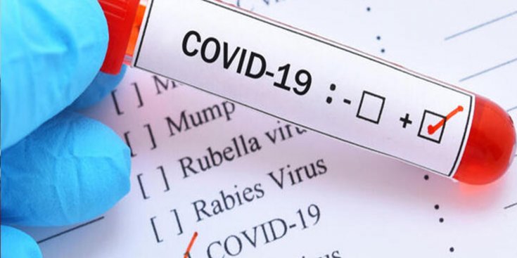 KKTC'de koronavirüs vaka sayısı 38'e yükseldi