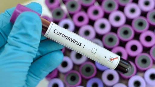 Koronavirüs test kriterleri değişiyor