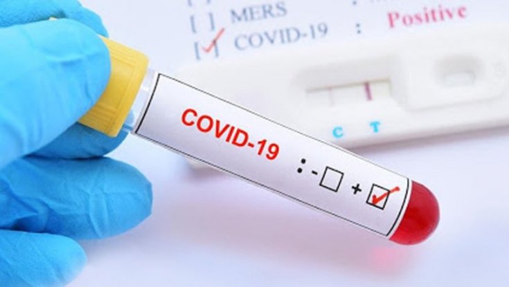 'Şubat ayında Covid-19 pozitif tanılı 24 hasta Mersin'de tedavi altına alınmış'