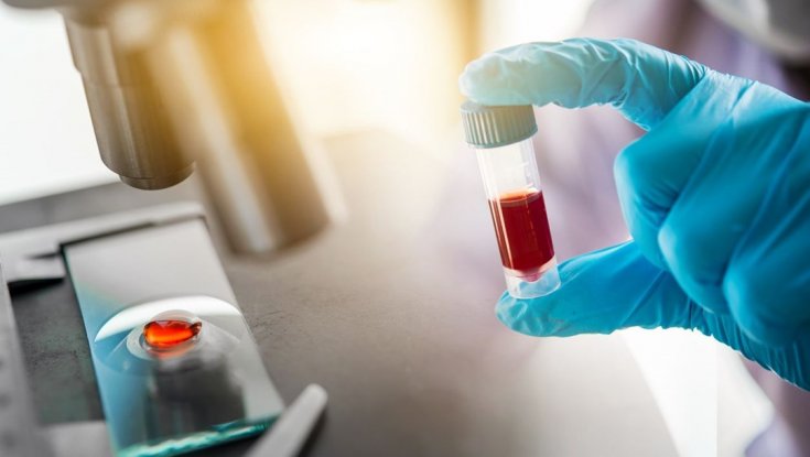 Araştırma: Yeni kan testi 50'den fazla kanser türünü tespit edebilir