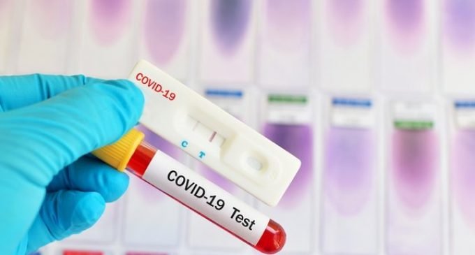 İstanbul'da PCR sahteciliği: 'COVİD-19 testi negatif' evrakı düzenleyerek binlerce kişi yurtdışına çıkmış İstanbul'da PCR sahteciliği: 'COVİD-19 testi negatif' evrakı düzenleyerek binlerce kişi yurtdışına çıkmış