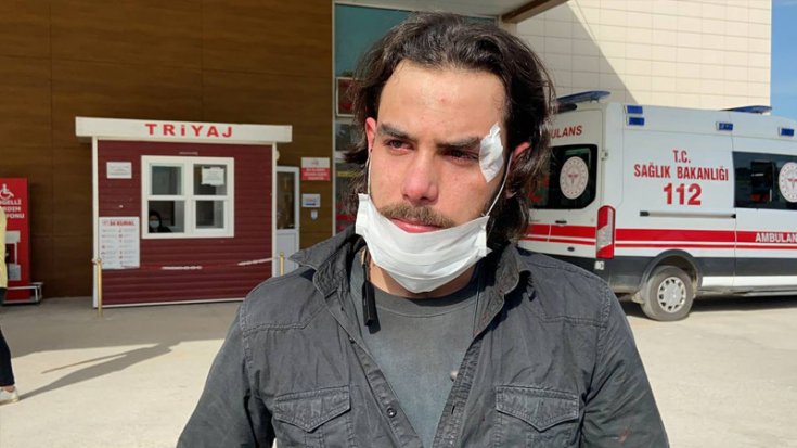 Maaşını isteyen Suriyeli işçi patronu tarafından dövüldü