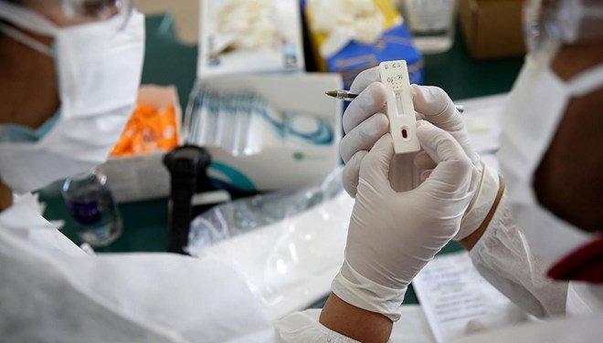 Oxford Üniversitesi 57 bin lira karşılığında yeniden koronavirüse yakalanmayı kabul eden gönüllüler arıyor