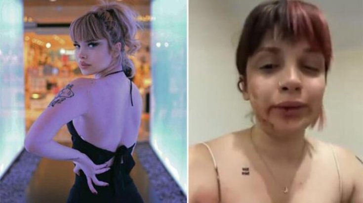 Tayt giydiği için oyuncu sevgilisi tarafından dövüldü Tayt giydiği için oyuncu sevgilisi tarafından dövüldü