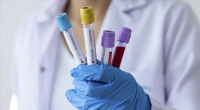Testsiz aşılılarda pozitif vakalar gözden kaçtı Testsiz aşılılarda pozitif vakalar gözden kaçtı