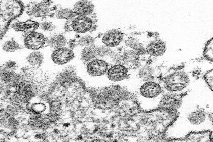 20 bin yıl önce bir koronavirüs salgını patlak vermiş