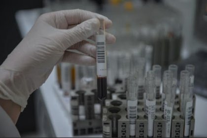 4 milyon kişi incelendi: Covid-19 geçiren kişilerde antikor seviyesi düşse de koruyuculuk devam ediyor