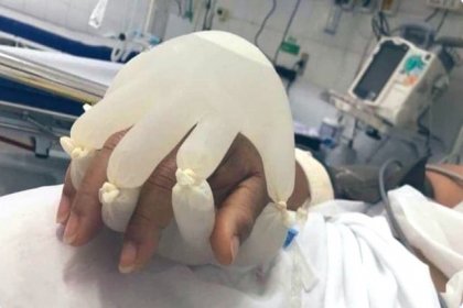 Brezilya'da Covid-19 yoğun bakımında yatan hastaların ellerini sıcak su dolu eldivenler tutuyor!